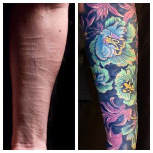 scar coverup william morris color